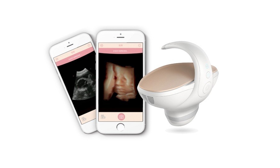 Escáner de ultrasonido fetal portátil 3D/4D aprobado por la CESolución portátil de imágenes de embarazo con sonda convexa de gran angular de 60°