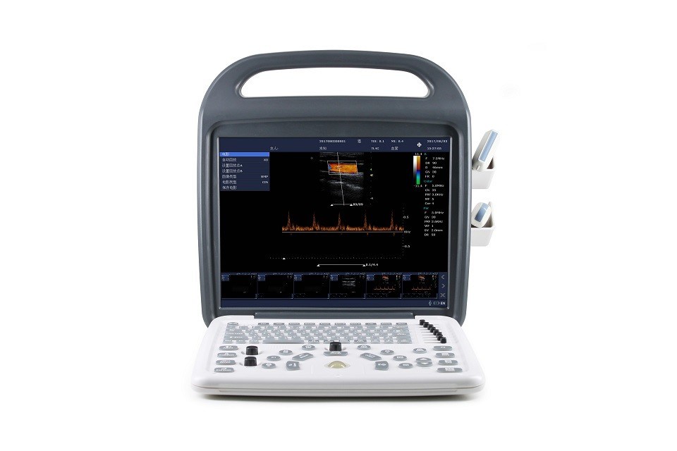 Sistema de ultrasonido Doppler color portátil DCU10 con pantalla HD de 15 pulgadas para imágenes de obstetricia, ginecología, abdomen y corazón